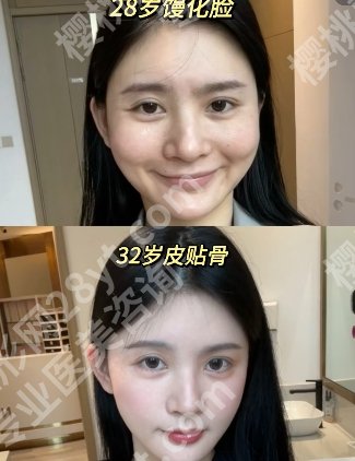 蒋铮铮馒化脸修复怎么样?医生坐诊医院及个人点评来袭