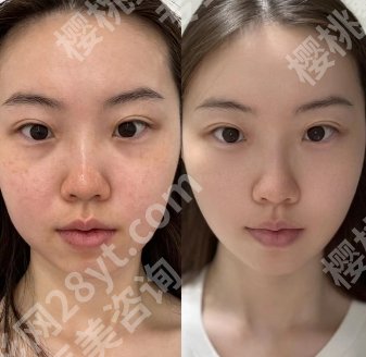 武汉濡白天使授权医生名单分享!朱胜军、胡煜、董海燕等技术可靠!