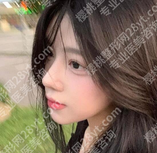 北京大学第一医院整形科怎么样？高热度好口碑！值得信赖