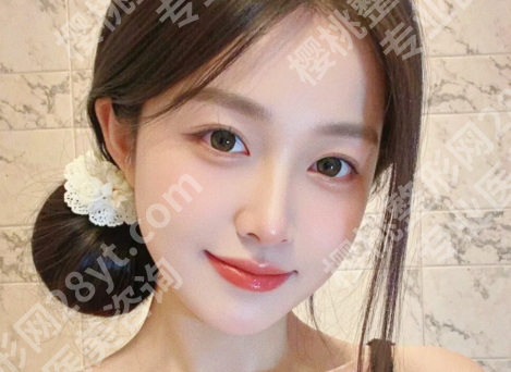 郑州何永强医生双眼皮怎么样？揭晓医生案例详情