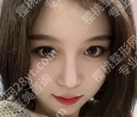 广东省皮肤病医院光子嫩肤多少钱？公布价格标准一览