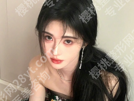 厦门郭彩春医生案例怎么样？速看案例过程一览