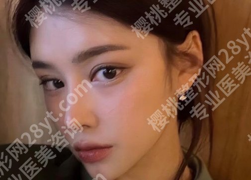 合肥面吸哪个医院好？壹加壹、韩美、恒美等医院均上榜！详情点击！
