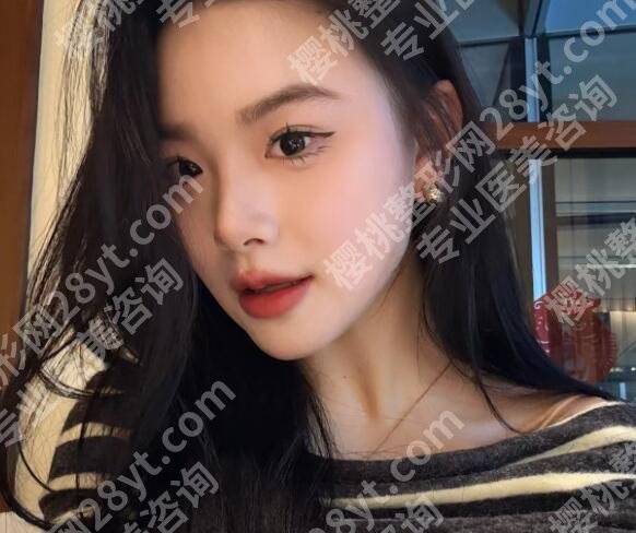 北京黄寺哪个医生拉皮都有谁？杜太超医生凭实力上榜！