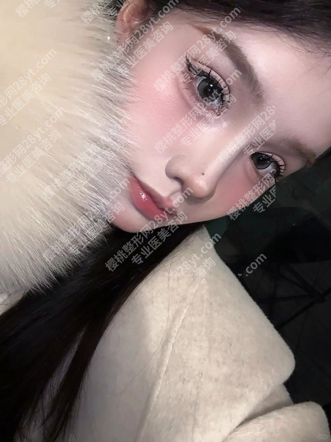 南京友谊医院整形双眼皮案例！明星项目和案例反馈