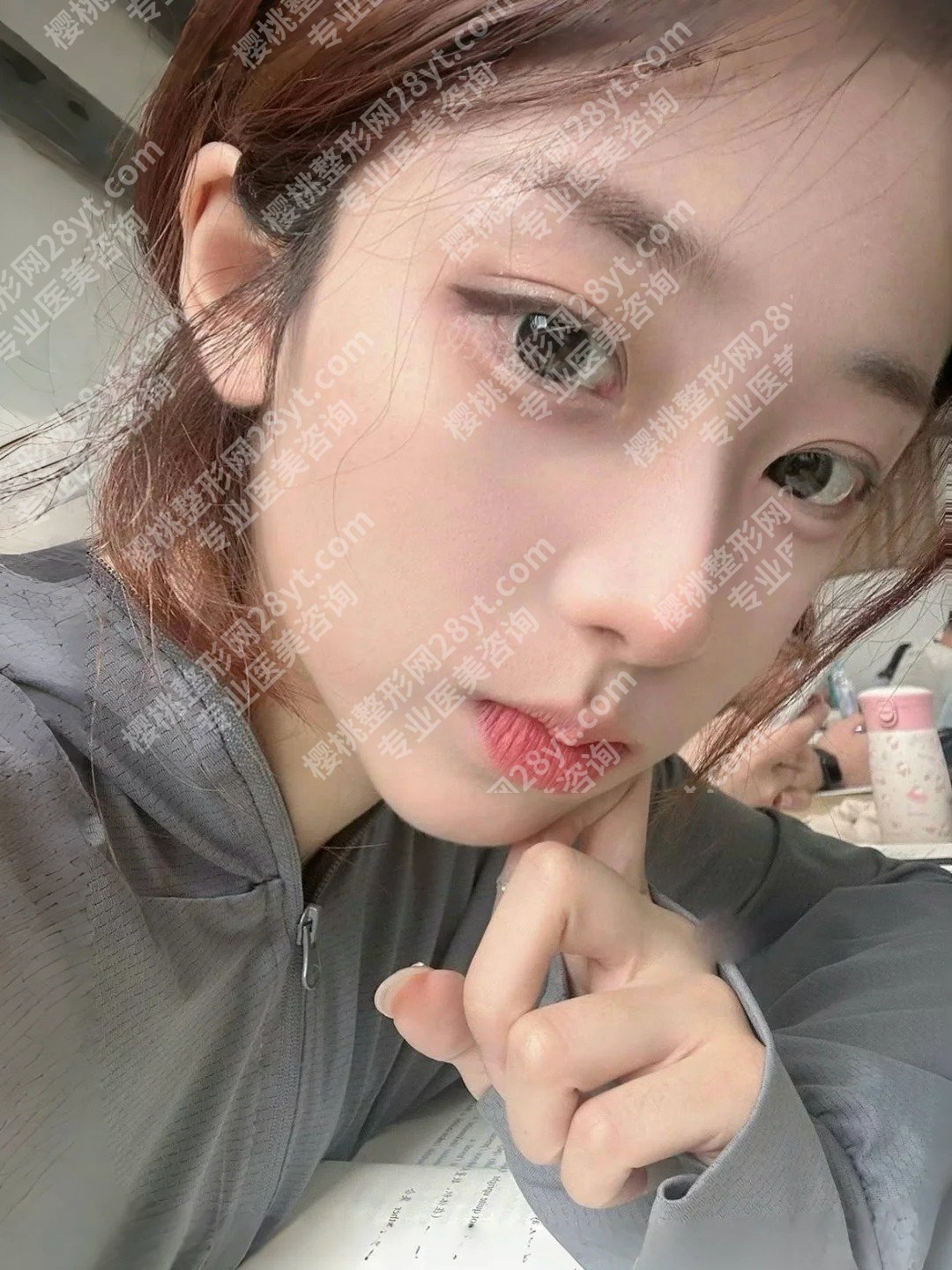天津美莱卜胜利技术怎么样？明星项目和技术优势反馈