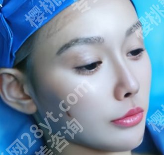 石家庄拉皮医生哪位做的好?张春莉、苏晓光、王晓等医生技术在线了解!