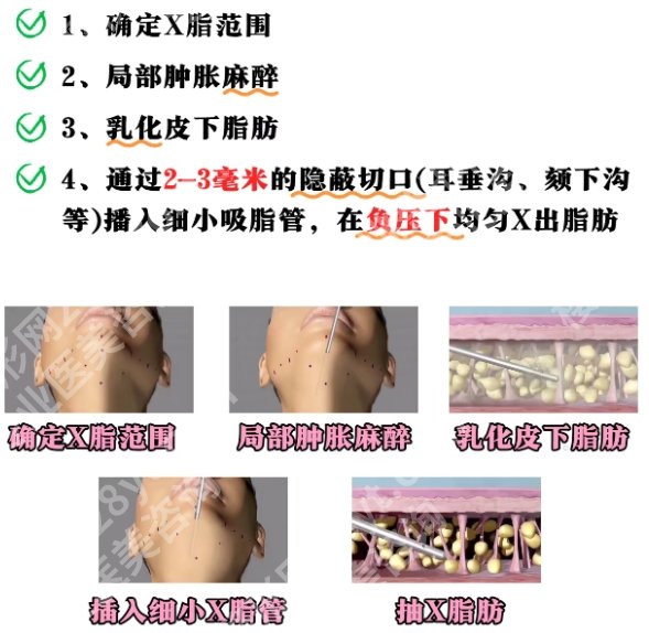 北京面部吸脂好的专家是谁?真实客户口碑来袭!来看相关介绍!