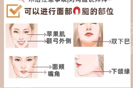 北京张春彦面吸技术好不好？真人案例图展示！来看对比
