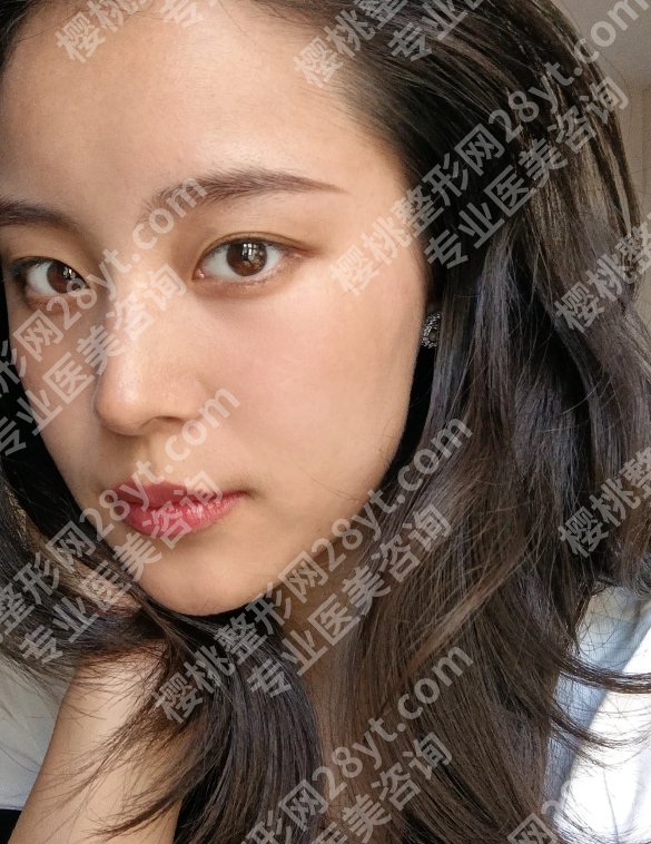 2025北京协和医院光子嫩肤多少钱一次?低至6000元左右起!附医院亮点