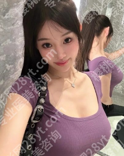 曾昂做胸价格介绍！2025假体隆胸大概4W-18W左右