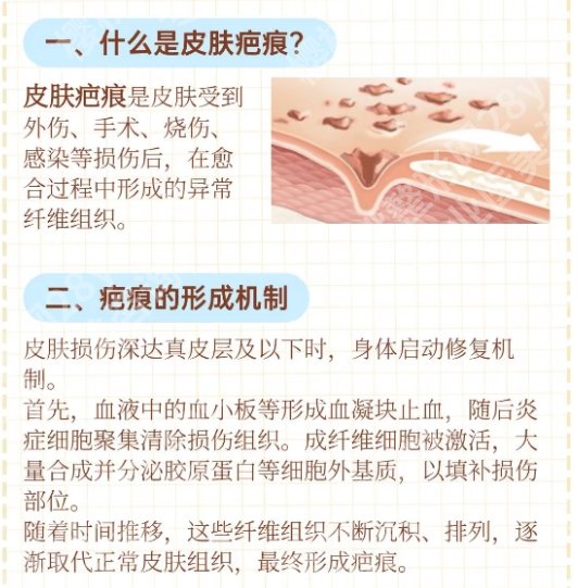 复旦大学附属儿科医院整形外科专家相关介绍！整形项目介绍！收藏再看！