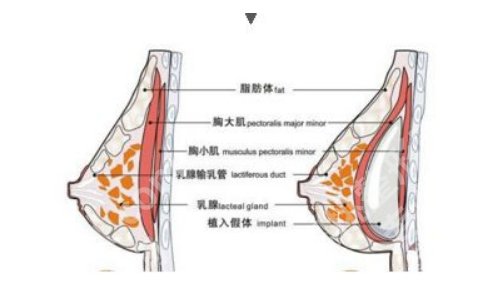 武汉同济医院吴毅平怎么样？明星项目、医生简介、坐诊医院更新！