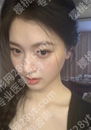 上海九院董佳生做鼻子怎么样？技术出众！附上真实口碑点评！
