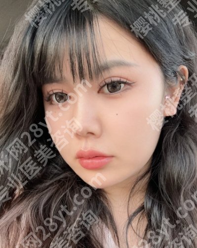 廖云君医生口碑怎么样?眼部综合、脂肪隆胸都不在话下!