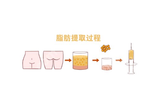 廖云君医生口碑怎么样?眼部综合、脂肪隆胸都不在话下!