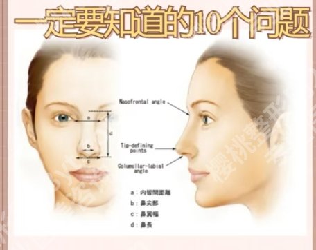 黄在弘垫过的鼻子反馈图来了！附网友手术过程分享！