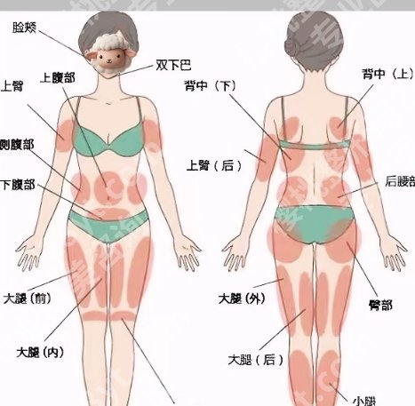 刘珍君吸脂技术靠谱吗？近期案例展示！来看效果图