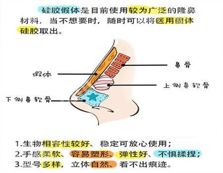 杭州张建文医生鼻子案例怎么样？隆鼻案例详情戳进来看