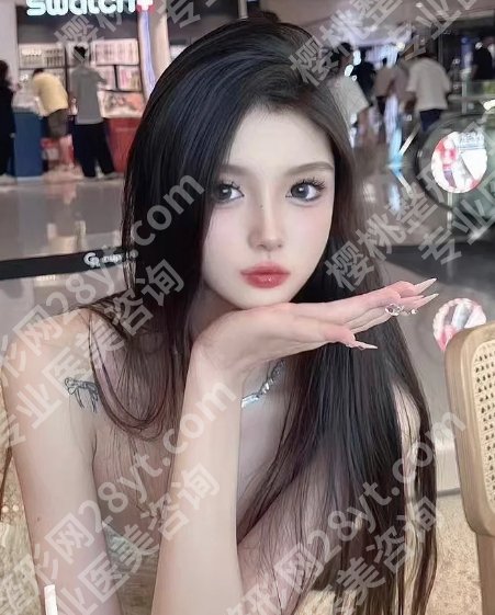 徐海艇医生自体脂肪案例分享！20多年经验、审美好、技术精湛！
