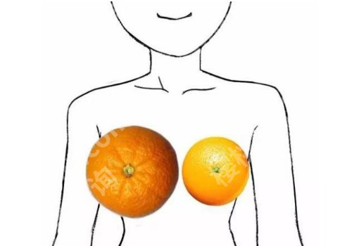 上海华山医院缩胸多少钱？2025更新价格3W+左右起！医生技术满分好评