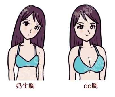 李高峰做胸贵吗西安国际医学坐诊吗？隆胸案例图反馈！
