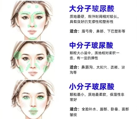 谭新东医生做下巴怎么样?医生信息、擅长项目介绍!