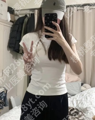 苏州市立医院缩胸手术费用是多少?2025参考价格3到10万左右!看完闭眼冲