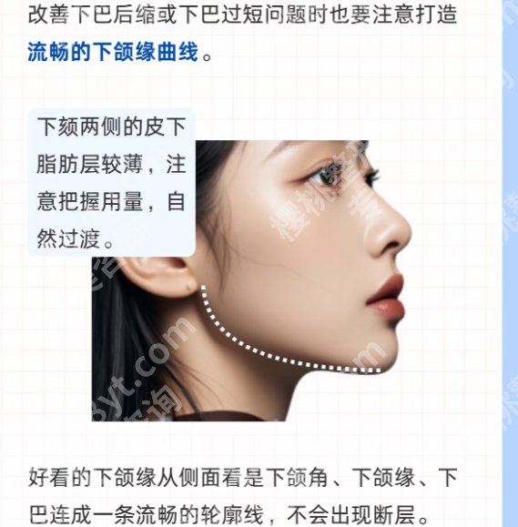 南京下巴整形多少钱?打玻尿酸6000元起!刘育凤、沈干等都很专家!