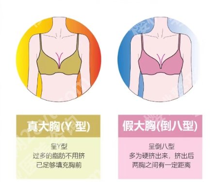 上海唐毅医生简介分享！医生实力测评、真人隆胸案例展示！