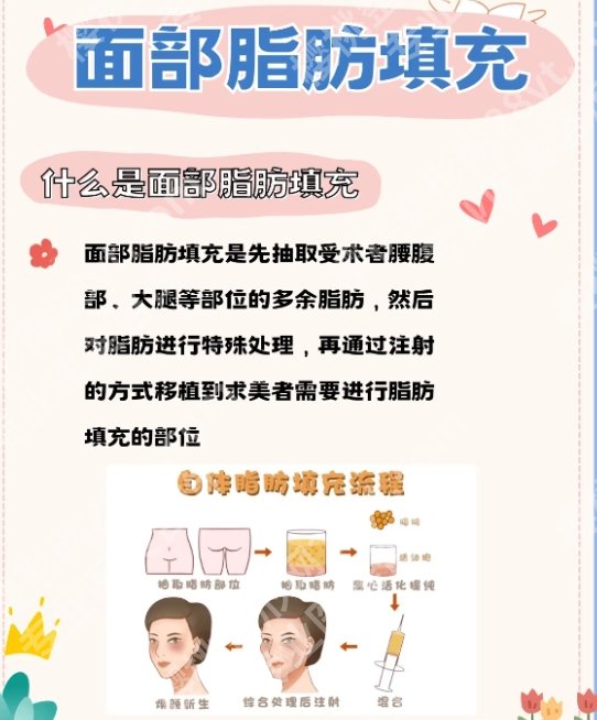 广州幼态脸打造是打针吗？哪个医院好？效果怎么样？来看详细介绍！