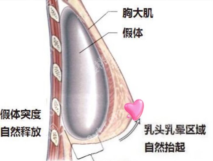 南京沈正宇隆胸手术的价格大约是多少？2025收费标准更新！