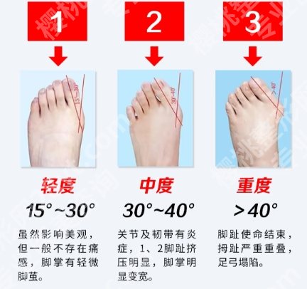苏敬达个人简历来袭！真人面诊过程附上！案例反馈
