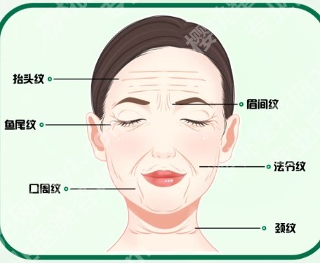 北京陈凤超拉皮失败案例图分享！来看前后差别！见证美丽蜕变