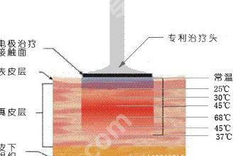 北京杜太超医生擅长的项目有哪些?小切口拉皮案例分享