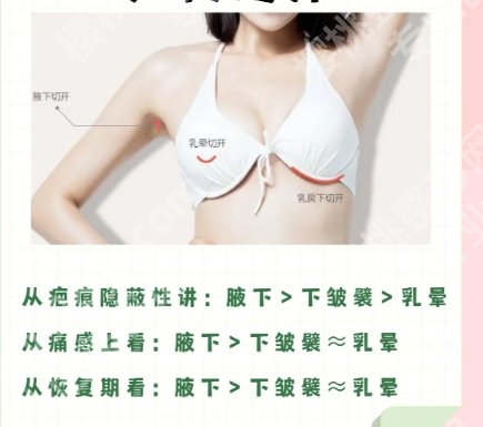 南京美莱沈正宇怎么样？临床经验丰富吗？隆胸案例反馈！