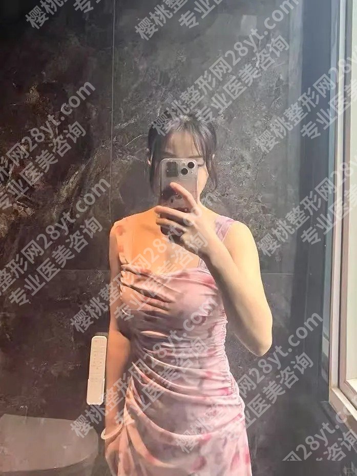 淄博中心医院缩胸多少钱？大概在2.7w起；附技术亮点