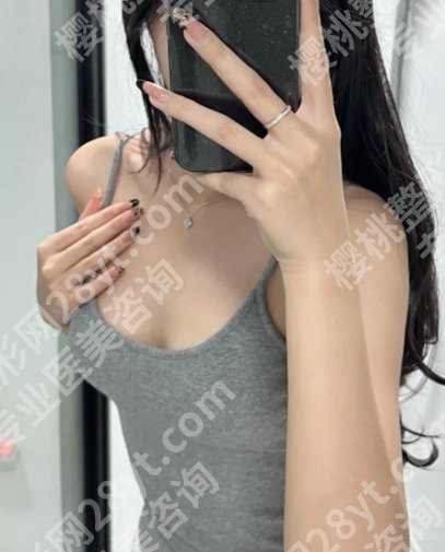 河南省人民医院缩胸手术谁的技术*好？康深松医生当仁不让！经验海量