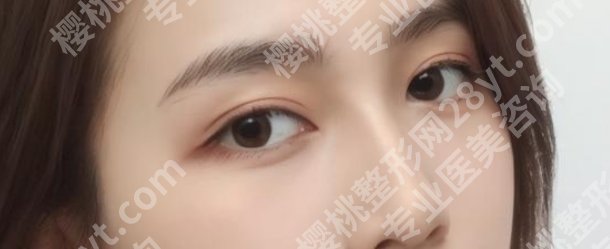 李竞医生做鼻子怎么样？戳进来看当地网友的真实反馈！
