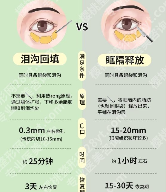 聂志宏医生做眼部脂肪填充怎么样啊？附价格表参考！点击收藏！