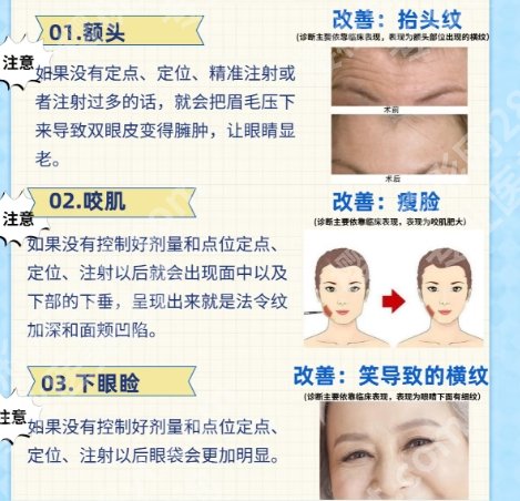北京丽合刘卓医生技术好不好？真实案例展示！见证蜕变