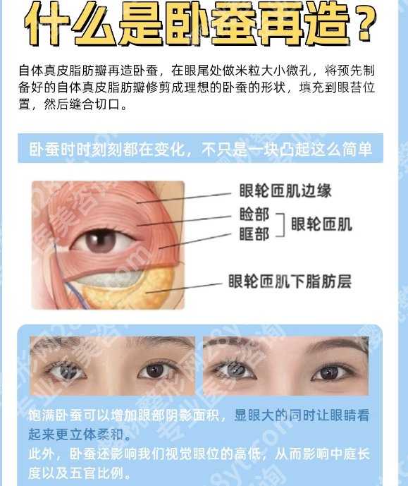 赵延勇做真皮卧蚕吗是真的吗？效果怎么样？戳进来看详细介绍！