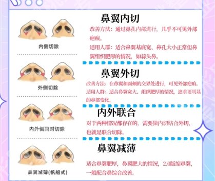 范荣杰做鼻修复怎么样？真人案例鉴赏！来看效果图