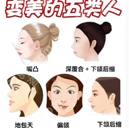 华山医院颌面外科医生名单更新！李凌志、朱东旺皆上榜！