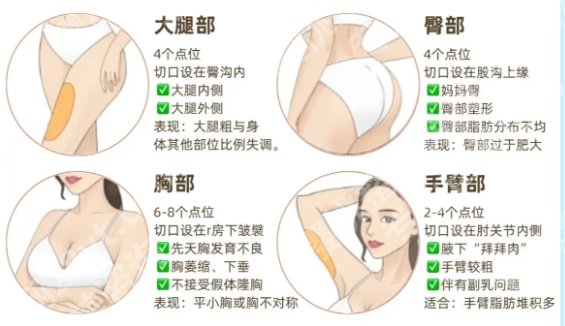 北京协和医院吸脂报价更新，1-2万元起，王阳、白明等人气和实力都很强！