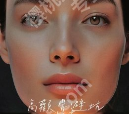 上海第九人民医院颧骨内推手术技术可靠吗？医师推荐！