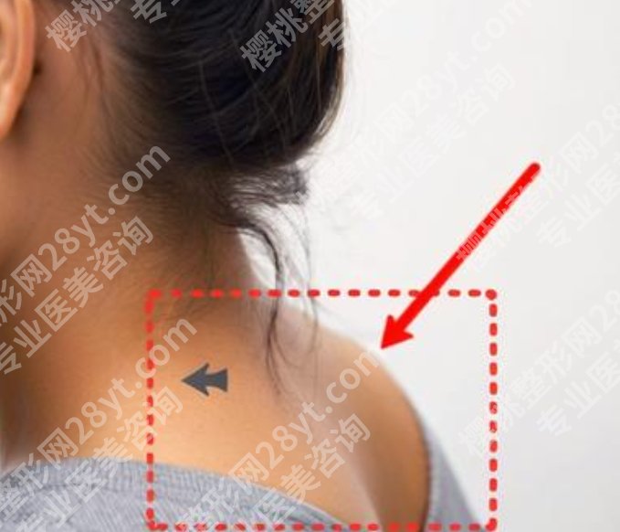 上海九院富贵包手术挂什么科？手术注意事项分享！