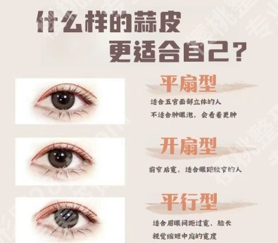 广州眼部整形专家排名前十名单更新！个个实力口碑兼具！