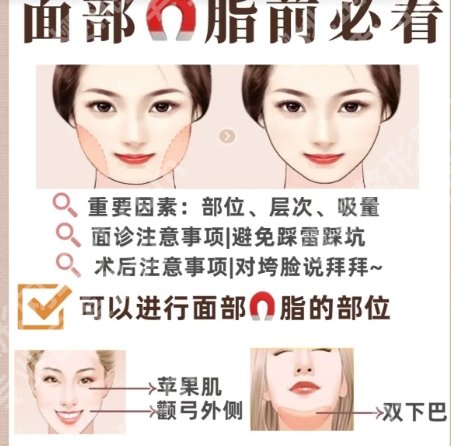 北京清木整形医院面部吸脂多少钱？1.7w元起步！技术优势等在线分享！