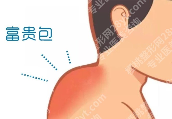 北京八大处富贵包哪个医生做的好？韩雪峰、刘温悦等都是技术派哦！